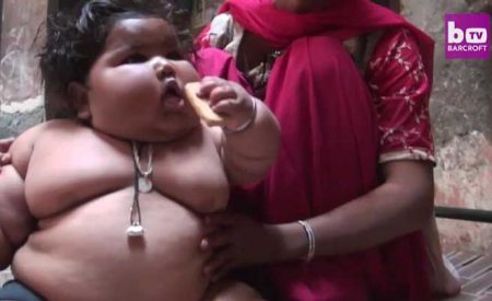 超重失常，印度8个月大婴儿重达17公斤