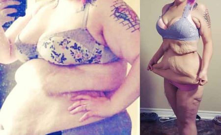 丢掉160斤肥肉，女子减肥前后对比照触目惊心